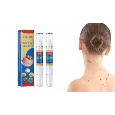 Skin Mole Removal Pen x1